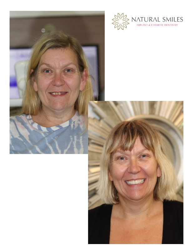 All on 4 Leicester smile face 2