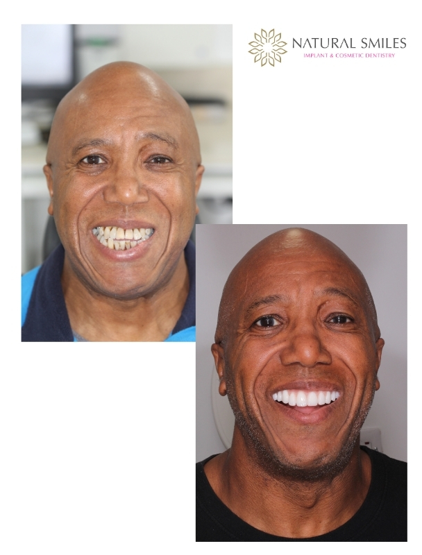 All on 4 Leicester smile face