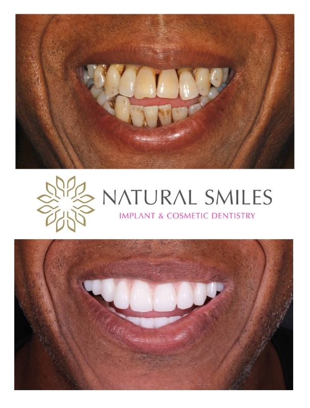 All on 4 Leicester smile